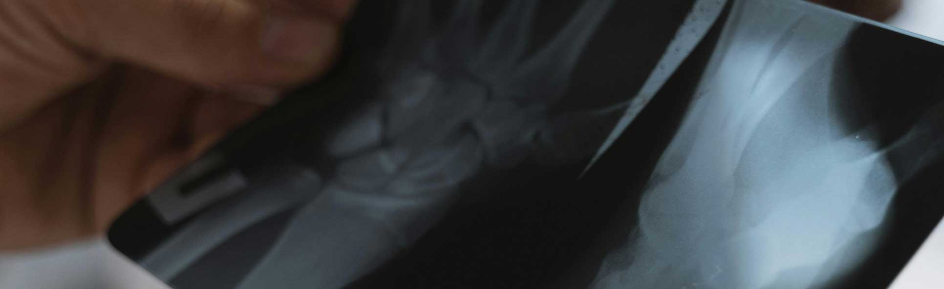 Philadelphia What Qualifies as Personal Injury?