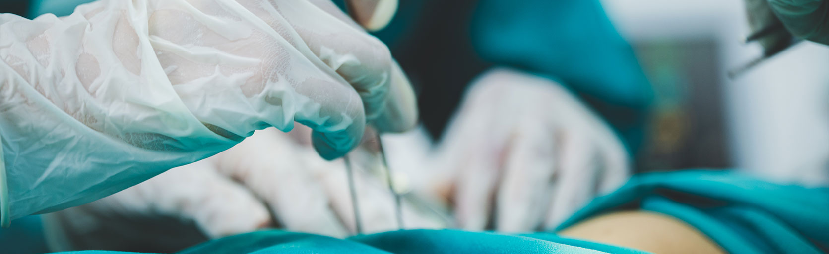 Philadelphia Most Common Surgical Errors that Lead to a Malpractice Lawsuit